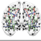Illustration for article titled The First Map Showing All the Connections in Your Brains White Matter
